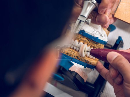 Photo for From above of crop anonymous male dental technician fixing ceramic tooth into non removable denture in articulator while working in professional laboratory - Royalty Free Image