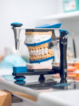 Photo for From above of set of metal ceramic implants of jaw denture installed into articulator for fixing on table of professional dental laboratory - Royalty Free Image