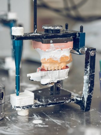 Photo for Closeup of gypsum jaw casts placed on articulator while preparing for creating denture in professional dental laboratory - Royalty Free Image