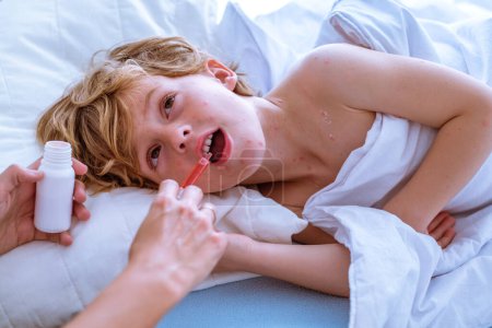 Photo for From above son with varicella blisters opening mouth and taking syrup from syringe given by crop mother while lying on bed in daytime at home - Royalty Free Image