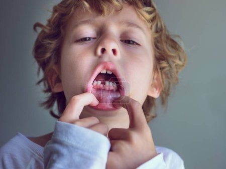Photo for From below of adorable little kid with curly blond hair showing open mouth with lost mol tooth while touching lip and looking at camera - Royalty Free Image