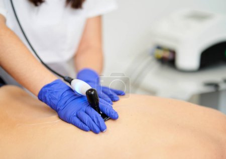 Foto de Una fisioterapeuta femenina que da tratamiento de diatermia en la espalda de la paciente. - Imagen libre de derechos