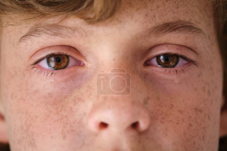 Foto de Primer plano del niño molesto de la cosecha con ojos marrones y lágrimas en la cara mirando a la cámara - Imagen libre de derechos