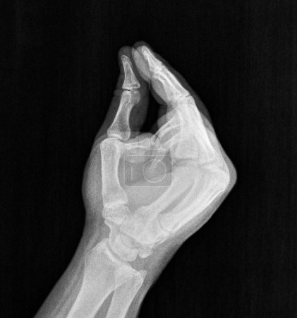 Film Röntgen oder Röntgenaufnahme einer Hand, Daumen und Zeigefinger Emoji-Geste zum Geldverdienen, Bezahlen, Bezahlen, Reich, Kleine Größe, Bezahlen, Bargeld, Münzen