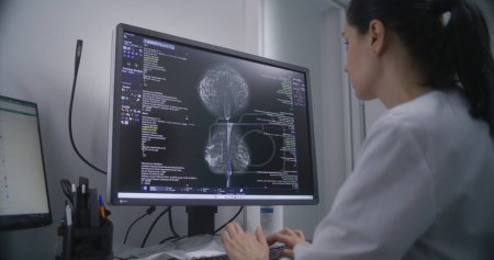 Professionelle Ärztin untersucht die Ergebnisse des Mammographie-Screenings am Computer. Mammographie-Scans von Brustgewebe, die auf dem PC-Bildschirm angezeigt werden. Brustkrebsvorbeugung. Krankenhaus oder Klinik.