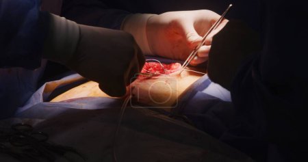 Photo for Close up of professional surgeons stitching cut. Medics operate patient in operating room. Nurse assists doctors, prepares and gives medical instruments. Medical staff at work in medical center. - Royalty Free Image