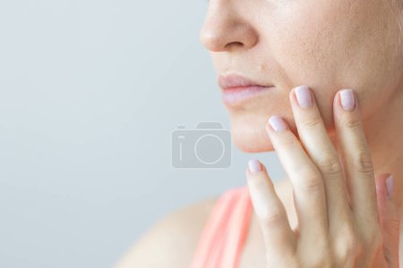 Woman with the mole above the lip. Young woman with nasolabial wrinkles, problem dry skin and with big pores on the face. 