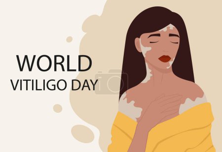 Jeune fille caucasienne illustration avec bannière vitiligo. Journée mondiale du vitiligo. Concept d'autosoin. Illustration de style dessin animé simple pour la conception graphique web