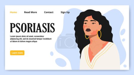 Psoriasis treatment banner, woman with allergic skin inflammation. Redness and irritation skin problems. Atopic dermatitis, eczema. Vector art for web graphic design