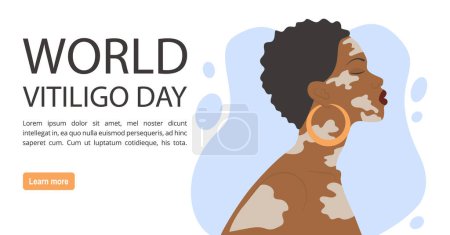 Illustration femme afro-américaine avec bannière vitiligo. Journée mondiale du vitiligo. Concept d'autosoin. Illustration de style dessin animé simple pour la conception graphique web