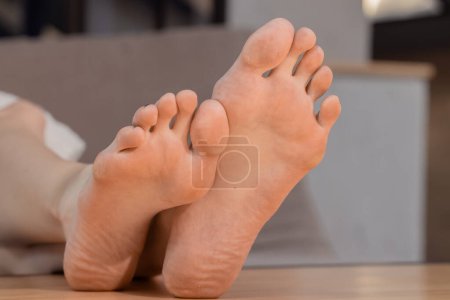 leicht schmutzige weibliche Füße bereit für Pediküre mit Schmutz auf der Haut und kleinen Problemen an den Fingern, Raum für häusliche Atmosphäre
