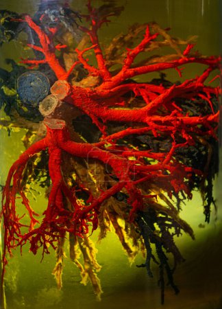 Téléchargez les photos : Navires du système circulatoire humain en solution de formaldéhyde à gros plan - en image libre de droit