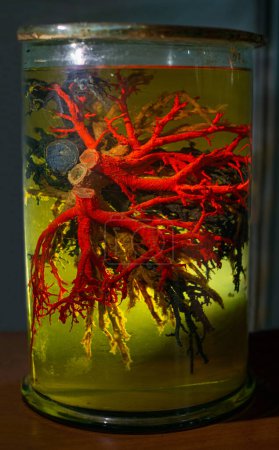 Foto de Buques del sistema circulatorio humano en solución de formaldehído - Imagen libre de derechos