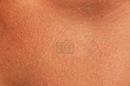 Brown human skin texture. Sunburned woman skin closeup
