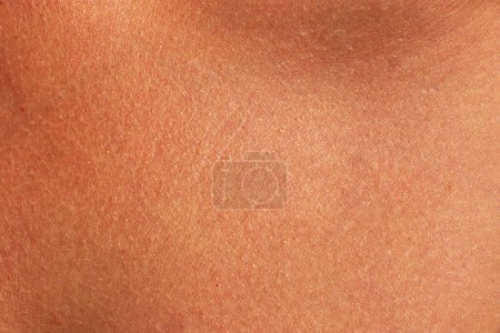 Téléchargez les photos : Texture de peau humaine brune. Femme brûlée de soleil peau gros plan - en image libre de droit