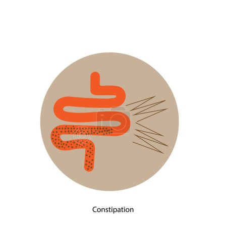 Illustration conceptuelle de la constipation 