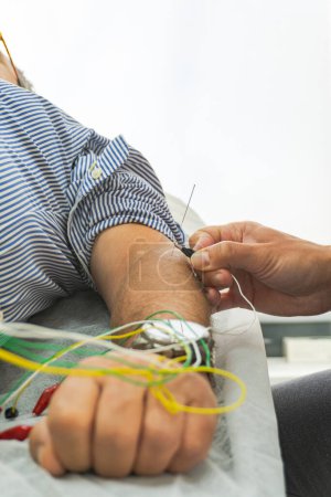 Photo for Close up a hand performing dry needling with cables and electrical currents, on the arm of a lying client - Royalty Free Image
