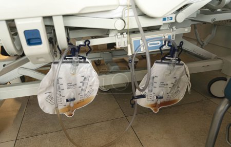 Foto de La parte inferior de una cama de hospital muestra dos bolsas de orina recogidas por tubos y catéteres - Imagen libre de derechos