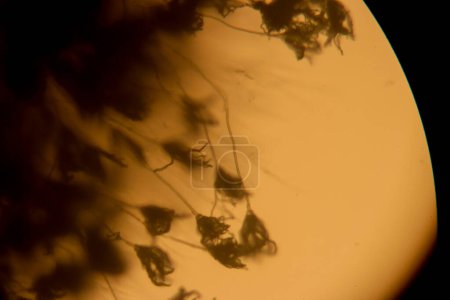 Photo for Rhizopus fungi specimen as seen through a microscope. High quality photo - Royalty Free Image