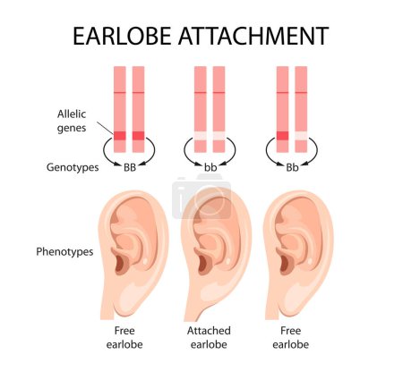 Attached earlobe and free earlobe