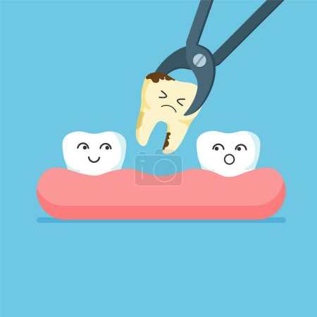 Illustration for Cartoon tooth is removed by forceps. Teeth row with dental implant. Vector illustration isolated on blue background. - Royalty Free Image