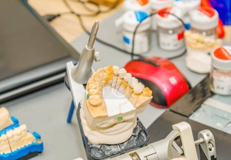 Photo for Plaster cast of the jaw in office of a dental technician - Royalty Free Image