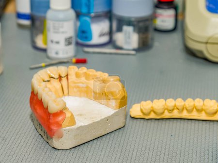 Foto de Fundición de yeso de la mandíbula en la oficina de un técnico dental - Imagen libre de derechos