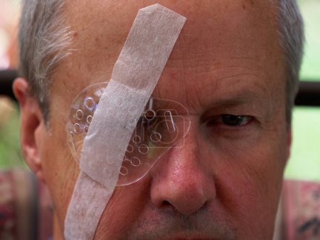 Photo for A transparent eye shield is taped over a man's eye to protect it while it heals from IOL surgery. - Royalty Free Image
