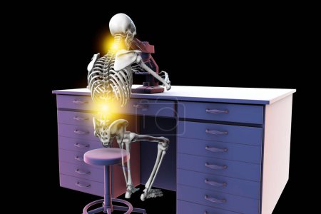 Téléchargez les photos : "Work-related skeletal disorders in laboratory workers, conceptual 3D illustration". Douleurs dorsales et cervicales chez le travailleur de laboratoire - en image libre de droit