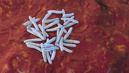 Foto de Bacterias Mycobacterium tuberculosis, el agente causal de la tuberculosis, ilustración 3D, se puede utilizar para M. leprae, complejo de M. avium y otras micobacterias - Imagen libre de derechos