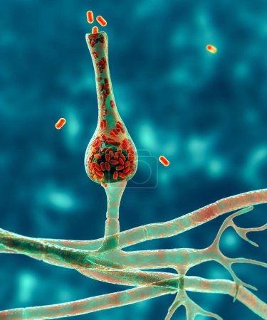 Foto de Saksenaea microscopic fungi, 3D illustration. Saksenaea vasiformis causes mucormycosis disease in humans, particularly after traumatic implantation, skin, bone and brain infections. - Imagen libre de derechos