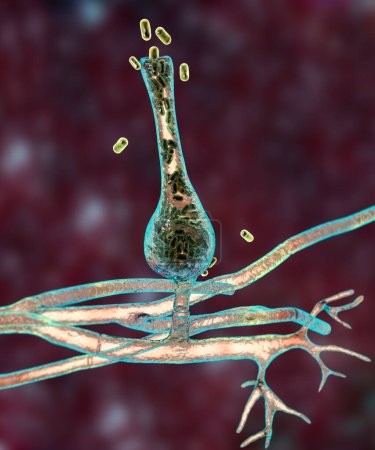 Foto de Saksenaea microscopic fungi, 3D illustration. Saksenaea vasiformis causes mucormycosis disease in humans, particularly after traumatic implantation, skin, bone and brain infections. - Imagen libre de derechos