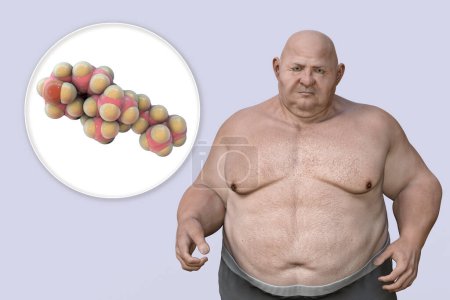 Photo for Obesity and dyslipidemia, conceptual 3D illustration showing cholesterol molecule and overweight person. Metabolic syndrome - Royalty Free Image