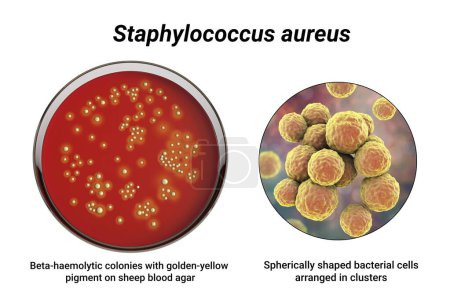 Photo for Bacteria Staphylococcus aureus, colonies on sheep blood agar medium and closeup view of the bacterial cells, 3D illustration - Royalty Free Image
