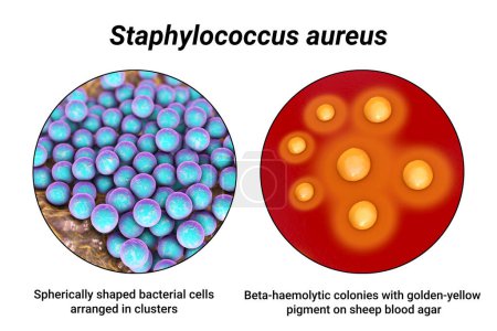Foto de Bacterias Staphylococcus aureus, colonias en medio agar sangre de oveja y vista de cerca de las células bacterianas, ilustración 3D - Imagen libre de derechos