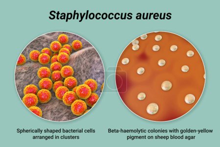 Photo for Bacteria Staphylococcus aureus, colonies on sheep blood agar medium and closeup view of the bacterial cells, 3D illustration - Royalty Free Image