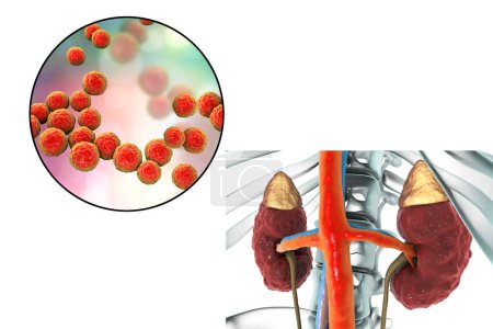 Téléchargez les photos : Pyelonephritis, medical concept, and close-up view of bacteria Enterococcus, the common causative agent of kidney infection, 3D illustration - en image libre de droit