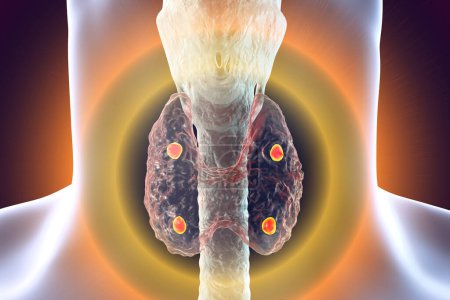 Foto de Glándulas paratiroideas y anatomía de la glándula tiroides, ilustración 3D - Imagen libre de derechos
