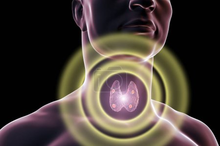 Téléchargez les photos : Thyroïde et glandes parathyroïdes dans le corps humain, illustration 3D - en image libre de droit
