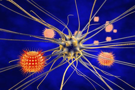 Viral encephalitis, brain cell infected by viruses, 3D illustration