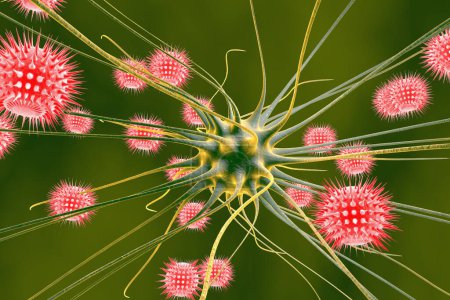 Téléchargez les photos : Encéphalite virale, cellules cérébrales infectées par des virus, illustration 3D - en image libre de droit