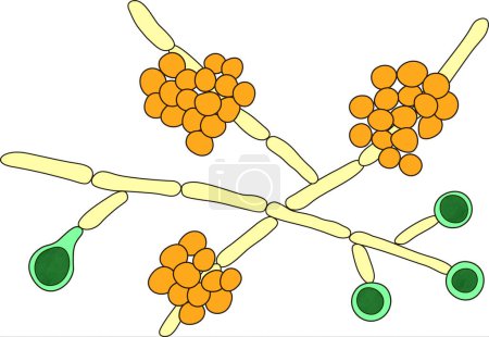 Téléchargez les photos : Candida albicans levures, l'agent causal de candidose. Illustration scientifique montrant des pseudohyphes (jaune), des blastoconidies (orange) et des chlamydospores (vert) - en image libre de droit