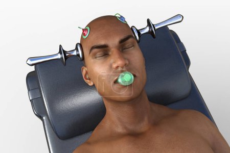 Foto de Terapia electroconvulsiva, ECT, un tratamiento utilizado para enfermedades mentales graves que implican el uso de corrientes eléctricas para estimular el cerebro, ilustración 3D - Imagen libre de derechos