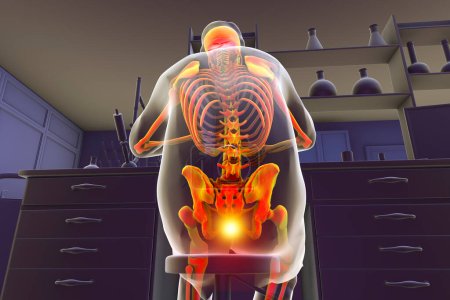 Téléchargez les photos : Un homme dans un environnement de laboratoire éprouvant de la douleur dans son coccyx, illustration 3D conceptuelle soulignant l'inconfort et les blessures possibles qui peuvent survenir à la suite d'activités prolongées assis ou répétitives - en image libre de droit