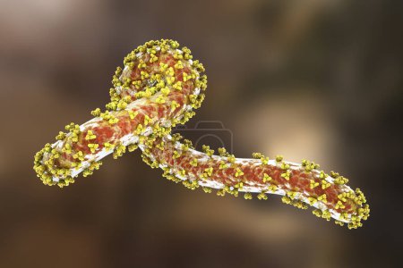 Photo for A skin rash on the chest of a patient with Marburg hemorrhagic fever, photorealistic 3D illustration - Royalty Free Image