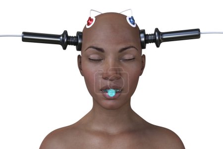Téléchargez les photos : Thérapie électroconvulsive, ECT, un traitement utilisé pour les maladies mentales graves impliquant l'utilisation de courants électriques pour stimuler le cerveau, illustration 3D - en image libre de droit