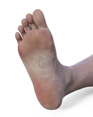 Téléchargez les photos : Illustration médicale scientifique 3D représentant le pied d'une femme d'âge moyen vu de la vue du bas, isolé sur fond blanc - en image libre de droit