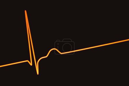 Foto de Electrocardiograma ECG que muestra un ritmo de unión, que ocurre cuando las señales eléctricas en el corazón se originan en la unión auriculoventricular en lugar del nodo sinoauricular, ilustración 3D - Imagen libre de derechos