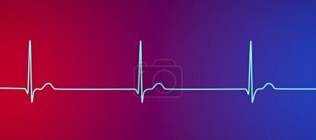 Téléchargez les photos : Électrocardiogramme ECG affichant un rythme conjonctionnel, qui se produit lorsque les signaux électriques dans le cœur proviennent de la jonction auriculo-ventriculaire au lieu du nœud sinoatrial, illustration 3D - en image libre de droit
