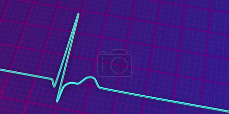 Photo for Electrocardiogram ECG displaying a junctional rhythm, which occurs when the electrical signals in the heart originate from the atrioventricular junction instead of the sinoatrial node, 3D illustration - Royalty Free Image